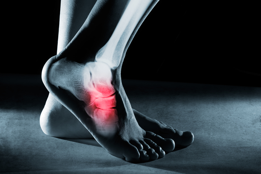 foot arch pain